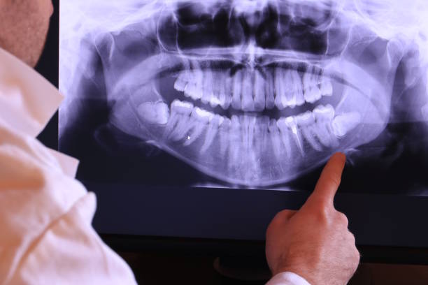 Best Emergency Tooth Extraction in Portales, NM